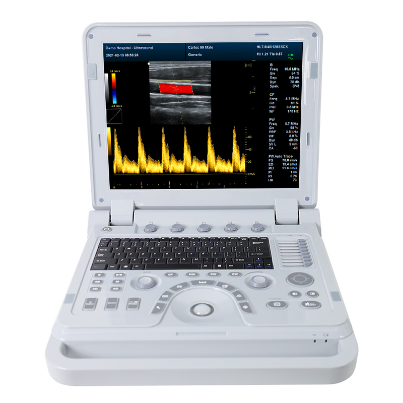 CONTEC CMS1700B Hand-carried Portable 3D 4D color flow ultrasound doppler system