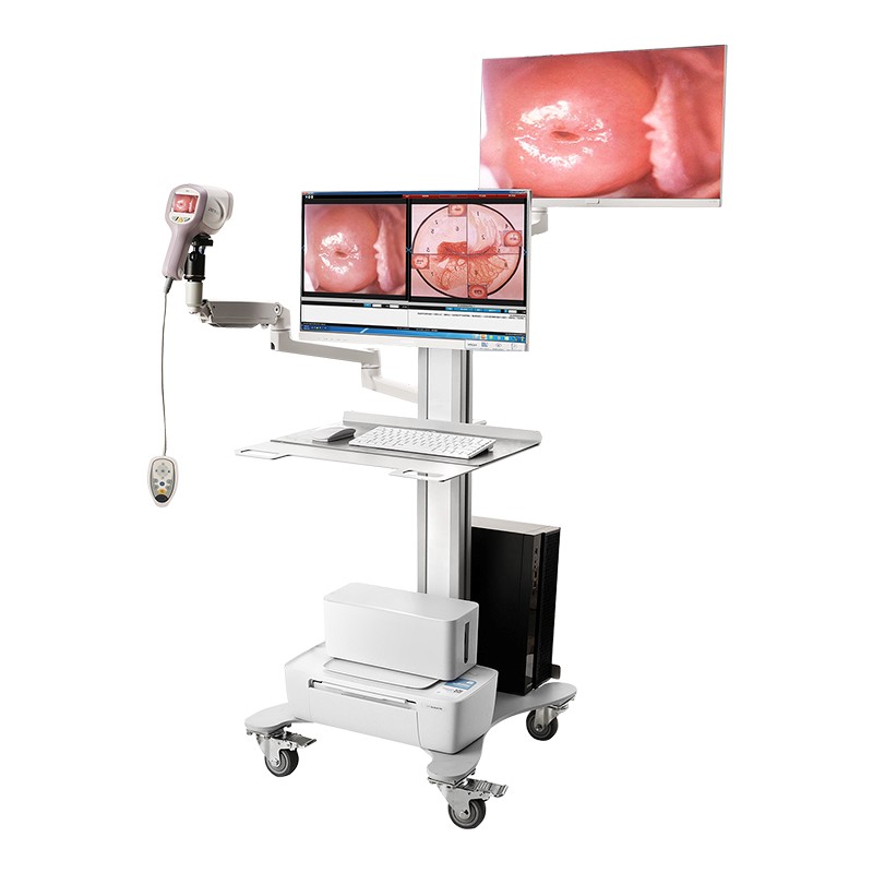 Full HD Gynecological Digital Video Colposcope KN-2200IH with Optional Dual Screens